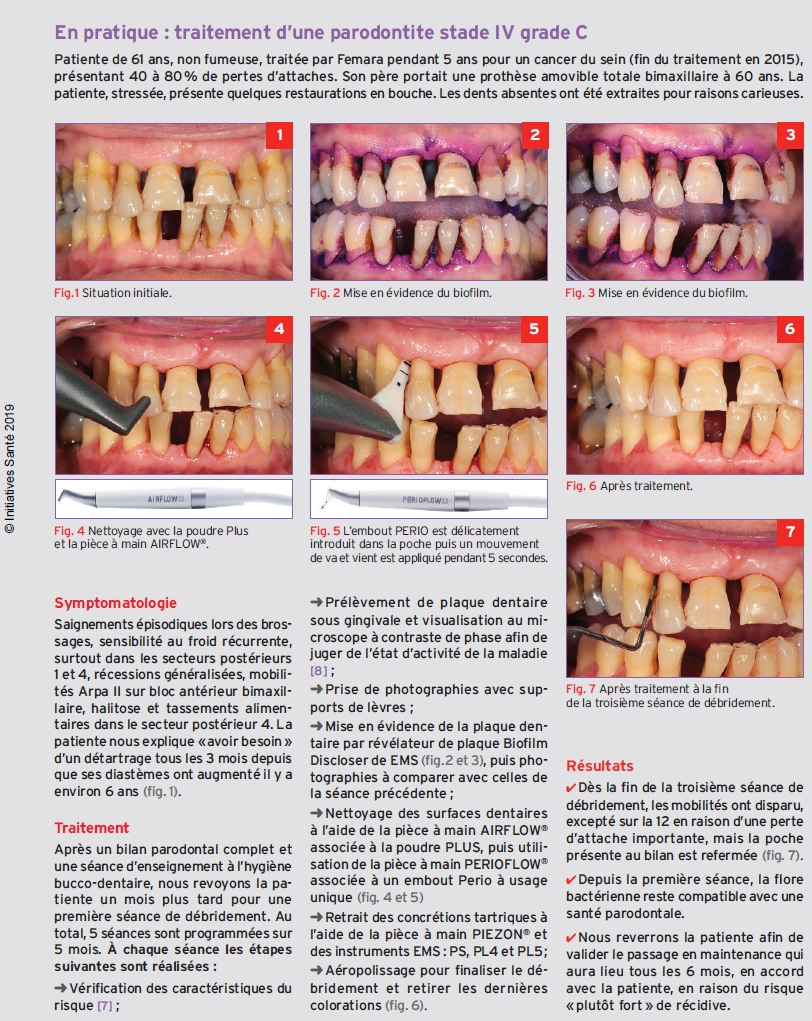 Dentiste Enlever Les Bandes De Caoutchouc Des Accolades Du Patient. Image  stock - Image du brides, émail: 222958585