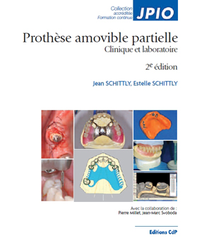 Prothèse amovible partielle (2e édition revue et mise à jour) J. Schittly, E. Schittly