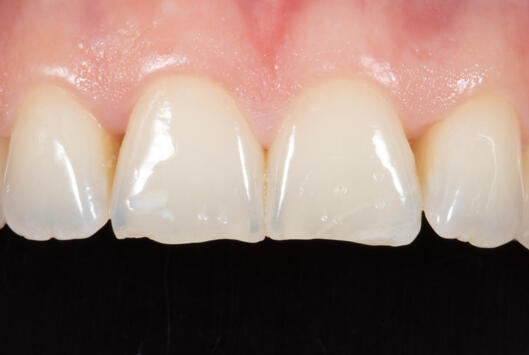 Optimiser la photographie dentaire numérique - Dentaire365