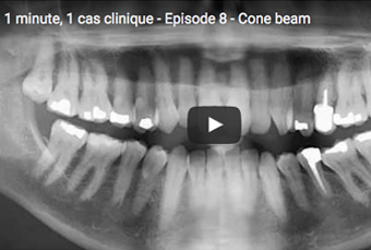 1 minute, 1 cas clinique - épisode 8 - du bon usage du cone beam