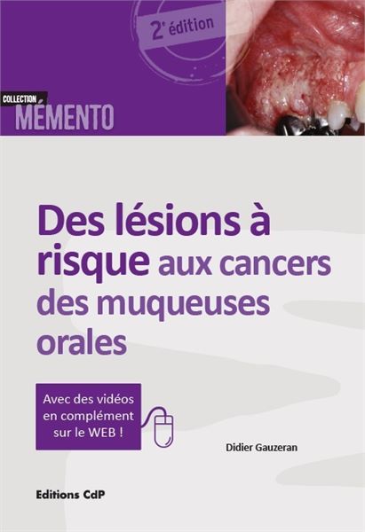Des lésions à risque aux cancers des muqueuses orales