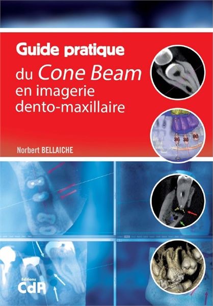 Guide pratique du Cone Beam en imagerie dento-maxillaire