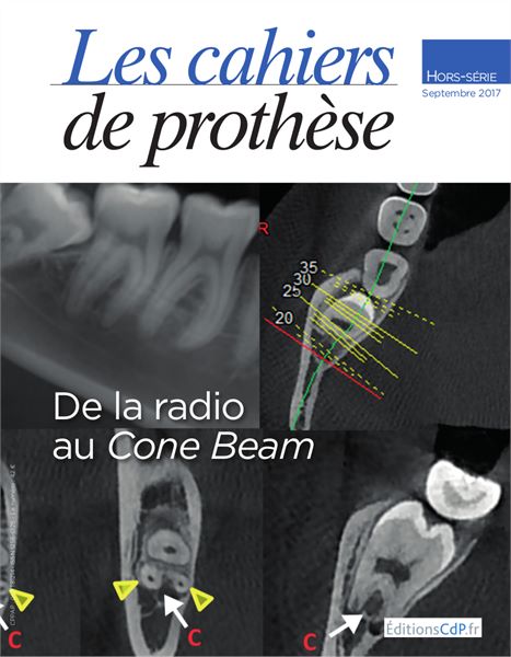 De la radio au Cone Beam - Hors-Série 2017 Revue Les cahiers de prothèse