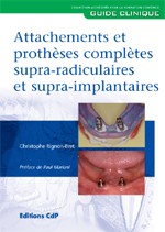 Attachements et prothèses complètes supra-radiculaires et supra-implantaires